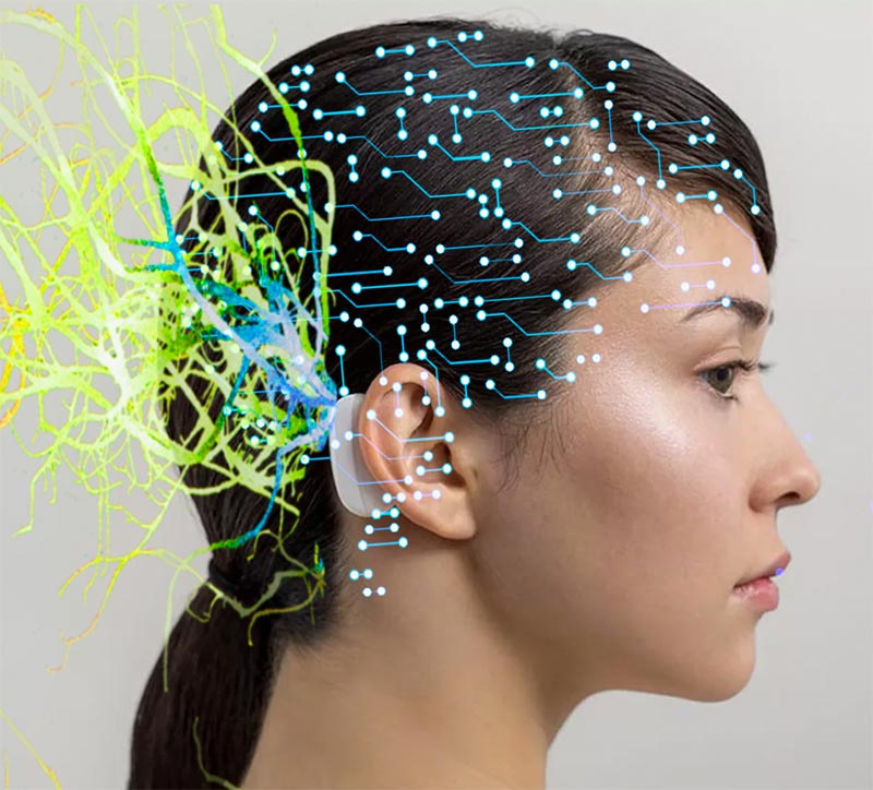 Major Milestone – Neural Lace Demo (Neurolink)