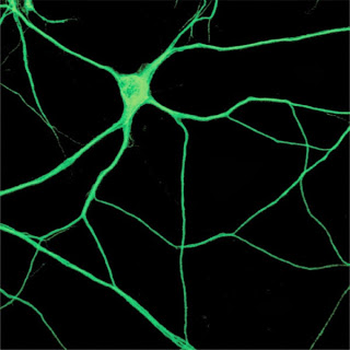 Microtubules the “tape archive” of the brain?